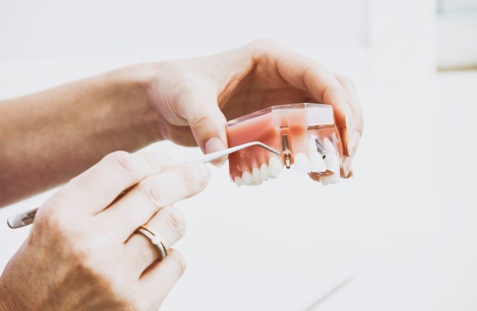 Implante dentário com carga imediata e sedação consciente revoluciona odontologia