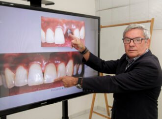 No Dia Mundial da Saúde Gengival, especialista alerta para relação entre saúde bucal, doenças sistêmicas e qualidade de vida